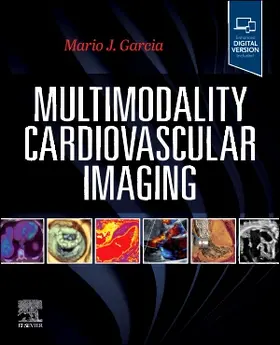 Garcia |  Multimodality Cardiovascular Imaging | Buch |  Sack Fachmedien