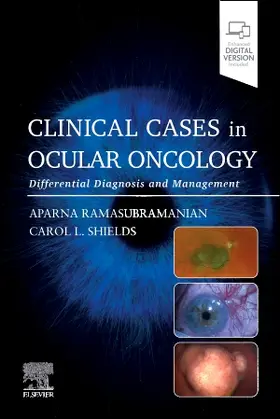 Ramasubramanian / Shields |  Clinical Cases in Ocular Oncology | Buch |  Sack Fachmedien