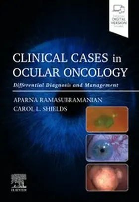 Ramasubramanian MD / Ramasubramanian / Shields MD |  Clinical Cases in Ocular Oncology - E-BOOK | eBook | Sack Fachmedien