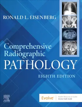 Eisenberg |  Comprehensive Radiographic Pathology | Buch |  Sack Fachmedien