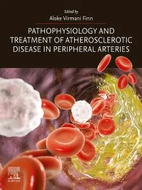Finn MD | Pathophysiology and Treatment of Atherosclerotic Disease in Peripheral Arteries | E-Book | sack.de