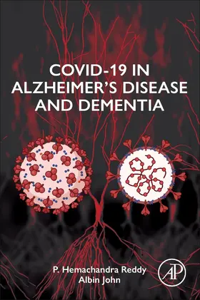 Reddy / John |  COVID-19 in Alzheimer's Disease and Dementia | Buch |  Sack Fachmedien