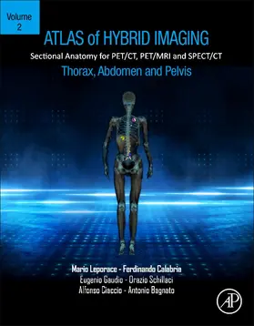 Gaudio |  Atlas of Hybrid Imaging Sectional Anatomy for PET/CT, PET/MRI and SPECT/CT Vol. 2: Thorax Abdomen and Pelvis | Buch |  Sack Fachmedien