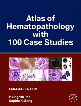Naeim / Rao / Song |  Atlas of Hematopathology with 100 Case Studies | Buch |  Sack Fachmedien