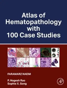 Naeim MD / Naeim / Rao |  Atlas of Hematopathology with 100 Case Studies | eBook | Sack Fachmedien