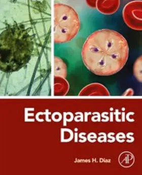 Diaz MD | Ectoparasitic Diseases | E-Book | www2.sack.de