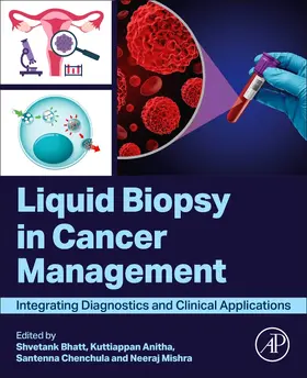 Anitha / Bhatt / Mishra |  Liquid biopsy in Cancer Management | Buch |  Sack Fachmedien