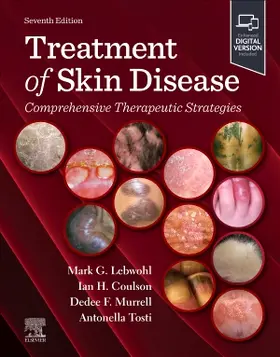 Lebwohl / Coulson / Murrell |  Treatment of Skin Disease: Comprehensive Therapeutic Strategies | Buch |  Sack Fachmedien