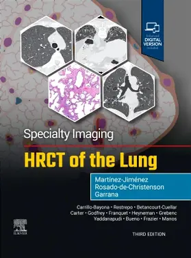 Martínez-Jiménez / Rosado-de-Christenson / Garrana |  Specialty Imaging: HRCT of the Lung | Buch |  Sack Fachmedien