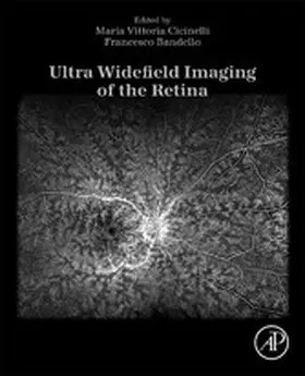 Cicinelli MD / Bandello MD / Bandello |  Ultra Widefield Imaging of the Retina | eBook | Sack Fachmedien