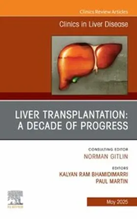 Martin |  Liver Transplantation: A Decade of Progress, An Issue of Clinics in Liver Disease | eBook | Sack Fachmedien
