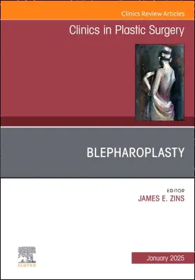 Zins |  Blepharoplasty, An Issue of Clinics in Plastic Surgery | Buch |  Sack Fachmedien