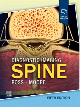 Ross / Moore |  Diagnostic Imaging: Spine | Buch |  Sack Fachmedien