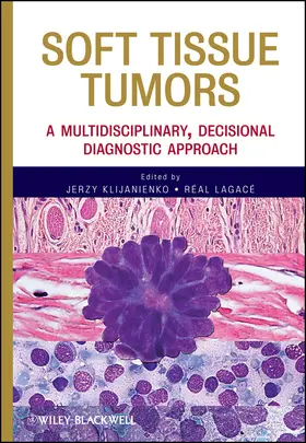 Klijanienko / Lagace |  Soft Tissue Tumors | Buch |  Sack Fachmedien