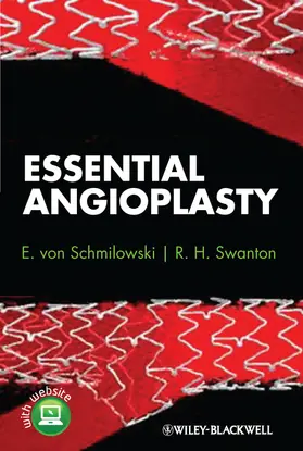 Schmilowski / Smilowska / Swanton |  Essential Angioplasty | Buch |  Sack Fachmedien