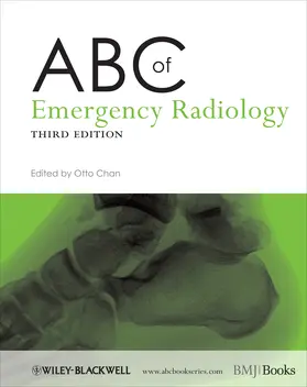 Chan | ABC of Emergency Radiology | Buch | 978-0-470-67093-4 | www2.sack.de