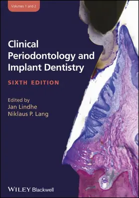 Lindhe / Lang | Clinical Periodontology and Implant Dentistry, 2 Volume Set | Buch | 978-0-470-67248-8 | sack.de