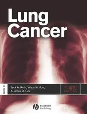 Roth / Cox / Hong |  Lung Cancer | eBook | Sack Fachmedien