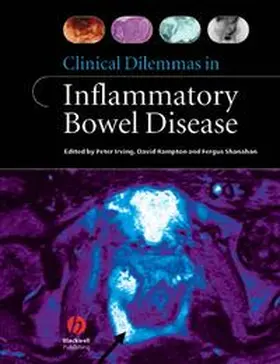 Irving / Rampton / Shanahan |  Clinical Dilemmas in Inflammatory Bowel Disease | eBook | Sack Fachmedien