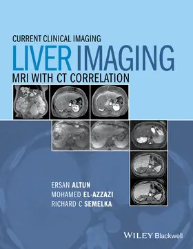 Altun / El-Azzazi / Semelka |  Liver Imaging | Buch |  Sack Fachmedien