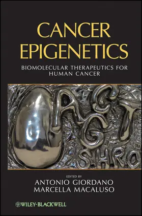 Giordano / Macaluso |  Cancer Epigenetics | Buch |  Sack Fachmedien