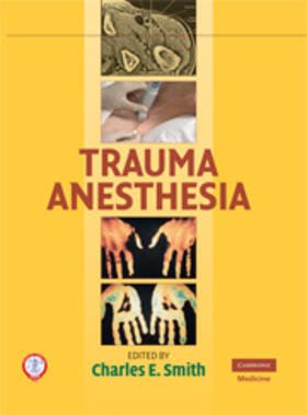 Smith |  Trauma Anesthesia | eBook | Sack Fachmedien