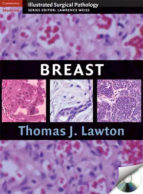 Lawton |  Illustrated Surgical Pathology of the Breast | Buch |  Sack Fachmedien