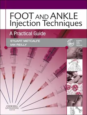 Metcalfe / Reilly |  Foot and Ankle Injection Techniques | Buch |  Sack Fachmedien