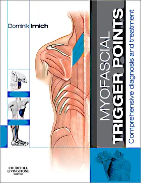 Irnich |  Myofascial Trigger Points | Buch |  Sack Fachmedien