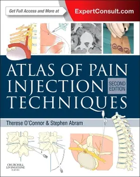 O'Connor / Abram |  Atlas of Pain Injection Techniques | Buch |  Sack Fachmedien