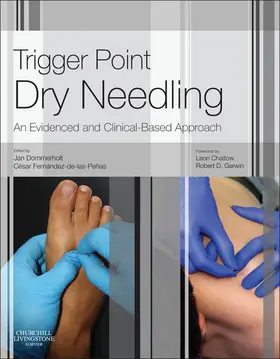 Dommerholt PT / Dommerholt |  Trigger Point Dry Needling E-Book | eBook | Sack Fachmedien