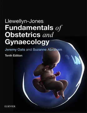 Oats MBBS / Abraham |  Llewellyn-Jones Fundamentals of Obstetrics and Gynaecology E-Book | eBook | Sack Fachmedien