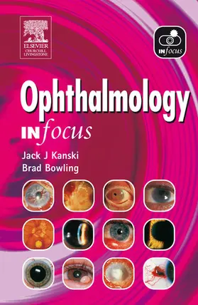 Bowling FRCSEd(Ophth) / Bowling |  Ophthalmology In Focus | eBook | Sack Fachmedien
