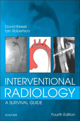 Kessel / Robertson |  Interventional Radiology: A Survival Guide E-Book | eBook | Sack Fachmedien