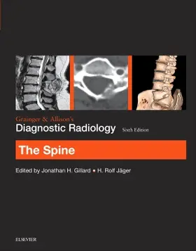 Gillard / Jager |  Grainger & Allison's Diagnostic Radiology: The Spine | Buch |  Sack Fachmedien