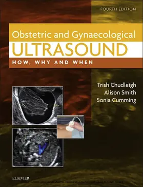 Chudleigh / Smith MSc / Smith |  Obstetric & Gynaecological Ultrasound | eBook | Sack Fachmedien