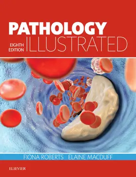 Roberts / MacDuff |  Pathology Illustrated E-Book | eBook | Sack Fachmedien