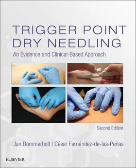 Dommerholt / Penas |  Trigger Point Dry Needling E-Book | eBook | Sack Fachmedien