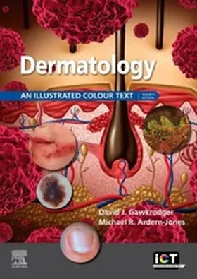 Gawkrodger / Ardern-Jones |  Dermatology E-Book | eBook | Sack Fachmedien