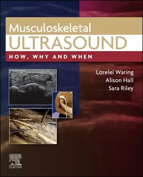 Hall / Waring / Riley |  Musculoskeletal Ultrasound | Buch |  Sack Fachmedien