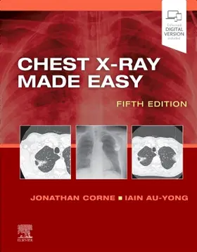 Corne / Au-Yong |  Chest X-Ray Made Easy | Buch |  Sack Fachmedien