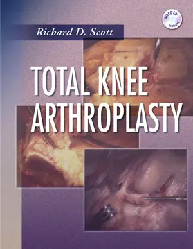 Scott |  Total Knee Arthroplasty | Buch |  Sack Fachmedien