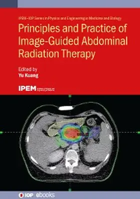Kuang | Principles and Practice of Image-Guided Abdominal Radiation Therapy | E-Book | sack.de
