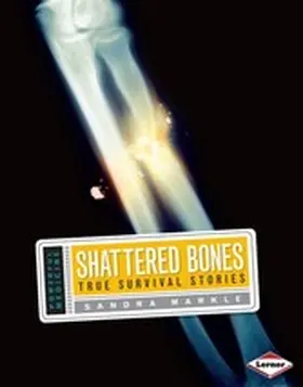 Markle |  Shattered Bones | eBook | Sack Fachmedien