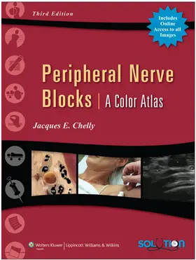 Chelly |  Peripheral Nerve Blocks | Buch |  Sack Fachmedien