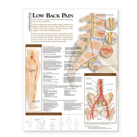  Understanding Low Back Pain Anatomical Chart | Buch |  Sack Fachmedien