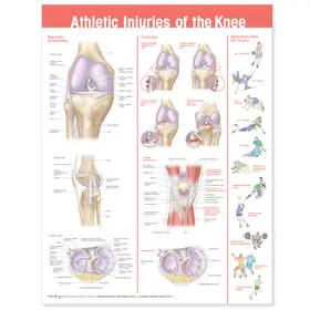  Athletic Injuries of the Knee Anatomical Chart | Sonstiges |  Sack Fachmedien