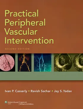 Casserly / Sachar / Yadav |  Practical Peripheral Vascular Intervention | Buch |  Sack Fachmedien