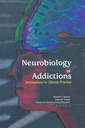 Straussner / Spence / Dinitto | Neurobiology of Addictions | Buch | 978-0-7890-1666-9 | sack.de
