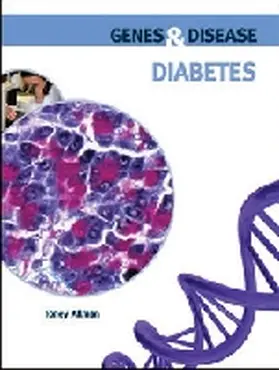 Allman |  Diabetes | Buch |  Sack Fachmedien